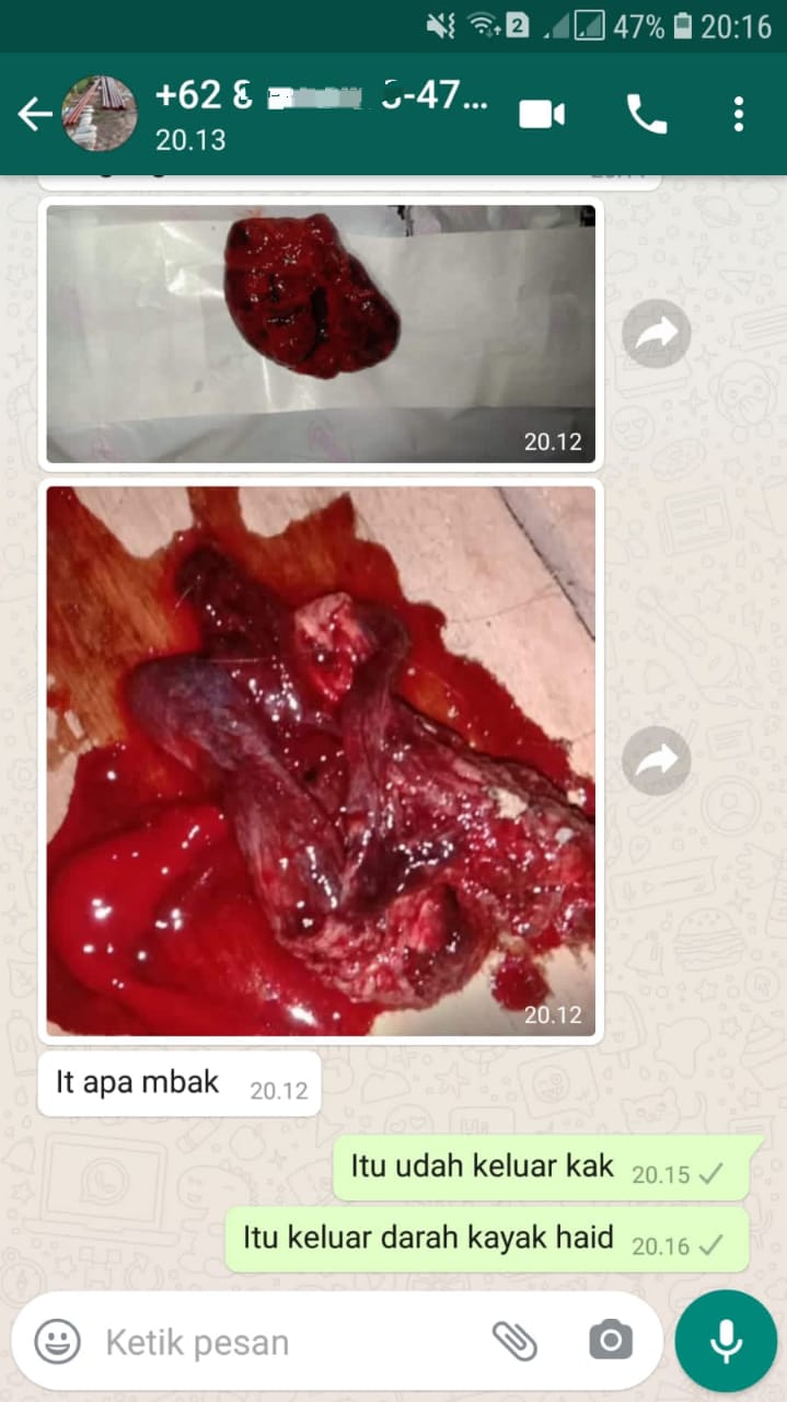 Testimoni 5